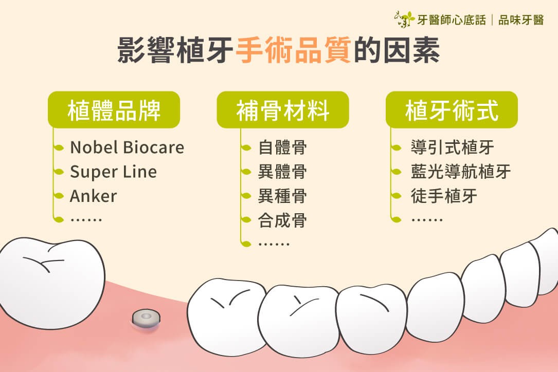 新數位導航助力植牙，專家分享關鍵提示